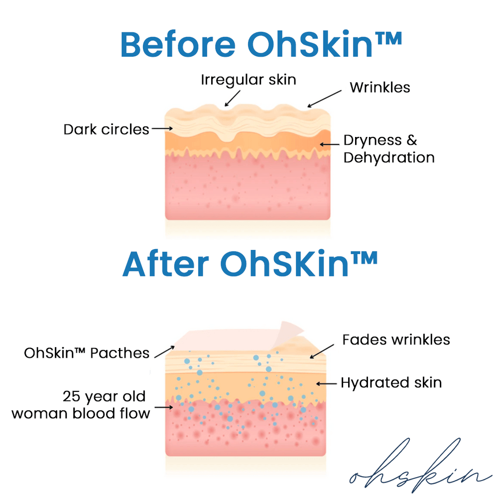 The OhSkin™ Patches : Say goodbye to your wrinkles now !